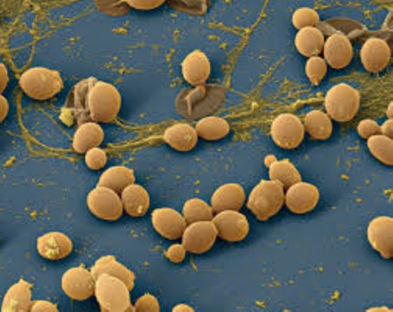 Enfermagem É Vida - CANDIDÍASE A candidíase é uma infecção causada pelo  fungo candida, geralmente candida albicans, entre 80 a 90% dos casos. Ela é  mais famosa por afetar os órgãos genitais